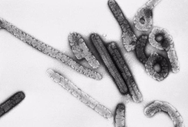 Tanzania confirma un brote de enfermedad por el virus de Marburgo